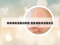 银屑病保湿霜润肤霜 银屑病擦保湿霜自愈