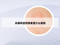 白癜风感到很累是什么原因