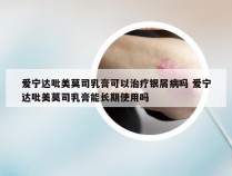 爱宁达吡美莫司乳膏可以治疗银屑病吗 爱宁达吡美莫司乳膏能长期使用吗