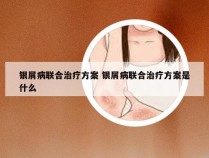 银屑病联合治疗方案 银屑病联合治疗方案是什么