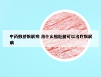 中药敷脐银屑病 用什么贴肚脐可以治疗银屑病