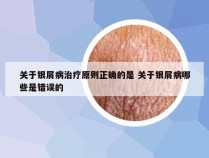 关于银屑病治疗原则正确的是 关于银屑病哪些是错误的