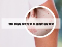 银屑病临床表现分型 银屑病的临床类型