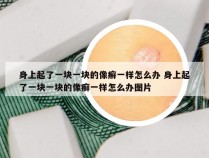 身上起了一块一块的像癣一样怎么办 身上起了一块一块的像癣一样怎么办图片