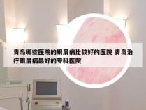 青岛哪些医院的银屑病比较好的医院 青岛治疗银屑病最好的专科医院