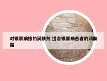 对银屑病擦的润肤剂 适合银屑病患者的润肤霜