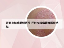 开封皮肤病朝鲜医院 开封皮肤病朝鲜医院地址