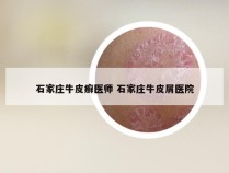 石家庄牛皮癣医师 石家庄牛皮屑医院