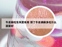 牛皮癣吃东风菜有用 得了牛皮病癣多吃什么蔬菜好
