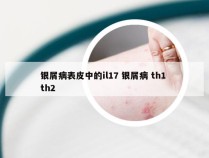 银屑病表皮中的il17 银屑病 th1 th2