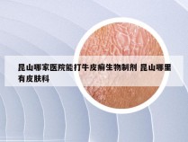 昆山哪家医院能打牛皮癣生物制剂 昆山哪里有皮肤科