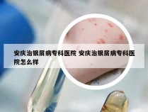 安庆治银屑病专科医院 安庆治银屑病专科医院怎么样