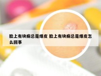 脸上有块癣总是爆皮 脸上有块癣总是爆皮怎么回事