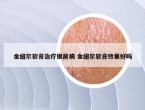 金纽尔软膏治疗银屑病 金纽尔软膏效果好吗