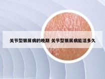 关节型银屑病的晚期 关节型银屑病能活多久