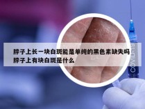 脖子上长一块白斑能是单纯的黑色素缺失吗 脖子上有块白斑是什么