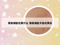 银屑病能吃黄什么 银屑病能不能吃黄瓜