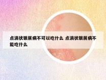 点滴状银屑病不可以吃什么 点滴状银屑病不能吃什么