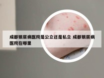 成都银屑病医院是公立还是私立 成都银屑病医院在哪里