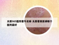 太原985医院看牛皮癣 太原看银屑病哪个医院最好