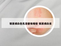 银屑病白色乳膏都有哪些 银屑病白皮