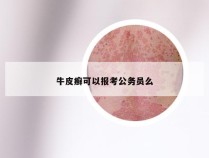 牛皮癣可以报考公务员么