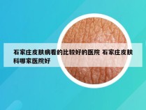石家庄皮肤病看的比较好的医院 石家庄皮肤科哪家医院好