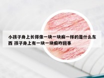 小孩子身上长得像一块一块癣一样的是什么东西 孩子身上有一块一块癣咋回事