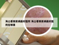 海口看银屑病最好医院 海口看银屑病最好医院在哪里