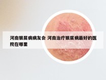 河南银屑病病友会 河南治疗银屑病最好的医院在哪里