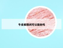 牛皮癣期间可以健身吗