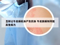 怎样让牛皮癣机体产生抗体 牛皮肤癣如何提高免疫力