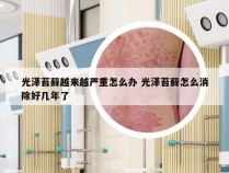 光泽苔藓越来越严重怎么办 光泽苔藓怎么消除好几年了