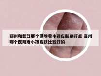 郑州和武汉那个医院看小孩皮肤病好点 郑州哪个医院看小孩皮肤比较好的
