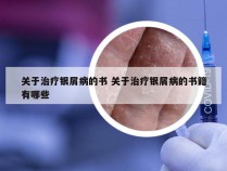 关于治疗银屑病的书 关于治疗银屑病的书籍有哪些