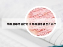 银屑病维持治疗方法 银屑病患者怎么治疗