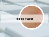 牛皮癣能吃纳豆吗