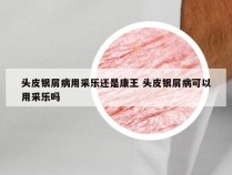 头皮银屑病用采乐还是康王 头皮银屑病可以用采乐吗