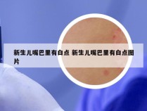 新生儿嘴巴里有白点 新生儿嘴巴里有白点图片