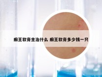 癣王软膏主治什么 癣王软膏多少钱一只