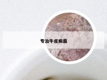 专治牛皮癣最