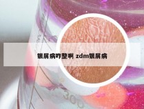 银屑病咋整啊 zdm银屑病