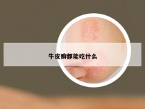 牛皮癣都能吃什么