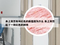 身上突然有块红色的癣是因为什么 身上突然起了一块红色的斑块