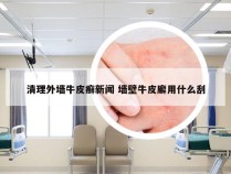 清理外墙牛皮癣新闻 墙壁牛皮廨用什么刮