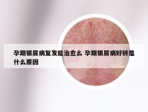 孕期银屑病复发能治愈么 孕期银屑病好转是什么原因