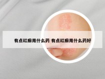 有点红癣用什么药 有点红癣用什么药好