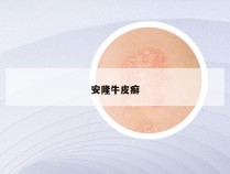 安隆牛皮癣