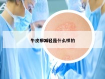 牛皮癣减轻是什么样的