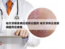 哈尔滨银屑病价低祥云医院 哈尔滨祥云皮肤病医院在哪里